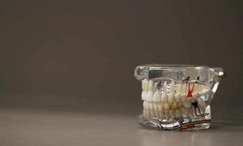 SmileDirectClub launches new retainer manufacturing technology